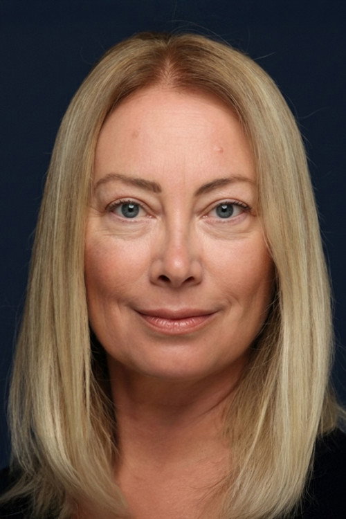 Alev Cınbarcı oyuncu fotoğrafı