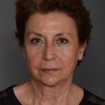 Serra Menderes
